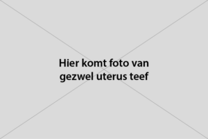 Uterus